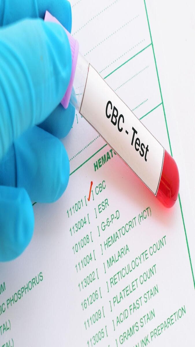 CBC Test Guide: Purpose, Normal Range, Results, Benefits & When You Need One